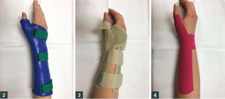 AJGP-11-2019-Focus-Allbrook-The-side-of-my-wrist-hurts-Fig-234.jpg